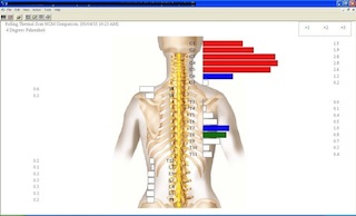 thermal scan patricia1