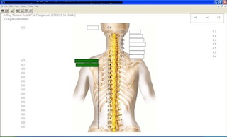 thermal scan patricia2